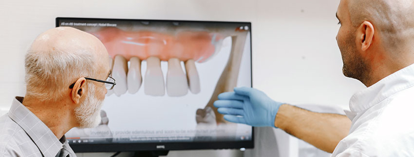 Impianti dentali - Dott. Luca Banfi - Centro Medico Poli3 Dolzago Lecco